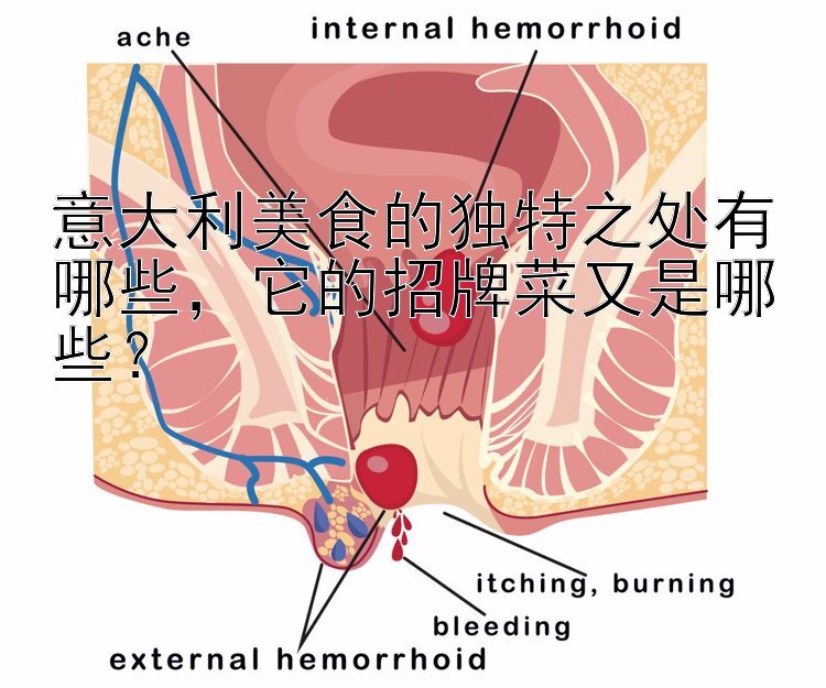 意大利美食的独特之处有哪些，它的招牌菜又是哪些？